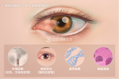 <strong>杏宇登陸紫外線輻射對眼睛的傷害</strong>